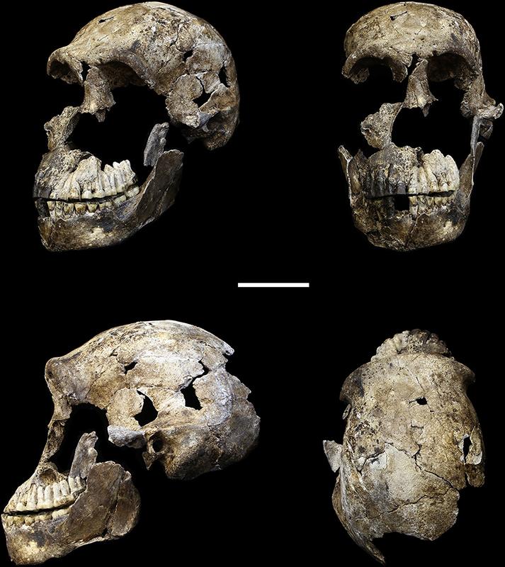 Front, side, and top views of skulls.