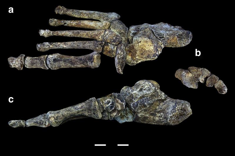 Side and top views of foot bones.