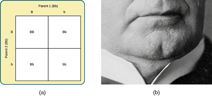 Image (a) is a Punnett square showing the four possible combinations (Bb, bb, Bb, bb) resulting from the pairing of a bb parent and a Bb parent. Image (b) is a close-up photograph showing a cleft chin.