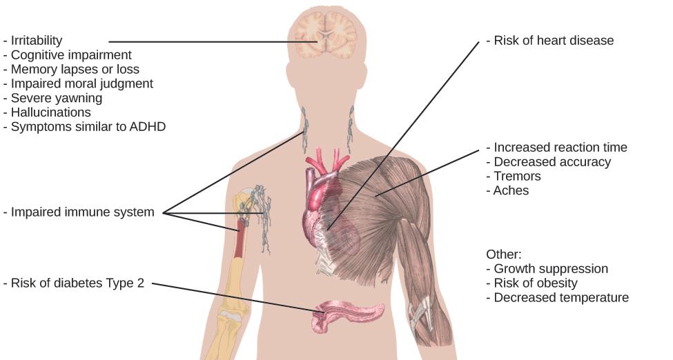 An illustration of the top half of a human body identifies the locations in the body that correspond with various adverse affects of sleep deprivation. The brain is labeled with “Irritability,” “Cognitive impairment,” “Memory lapses or loss,” “Impaired moral judgment,” “Severe yawning,” “Hallucinations,” and “Symptoms similar to ADHD.” The heart is labeled with “Risk of heart disease.” The muscles are labeled with “Increased reaction time,” “Decreased accuracy,” “Tremors,” and “Aches.” There is an organ near the stomach labeled “Risk of diabetes Type 2.” Various parts of the neck, arm, and underarm are labeled “Impaired immune system.” Other risks include “Growth suppression,” “Risk of obesity,” “Decreased temperature.”