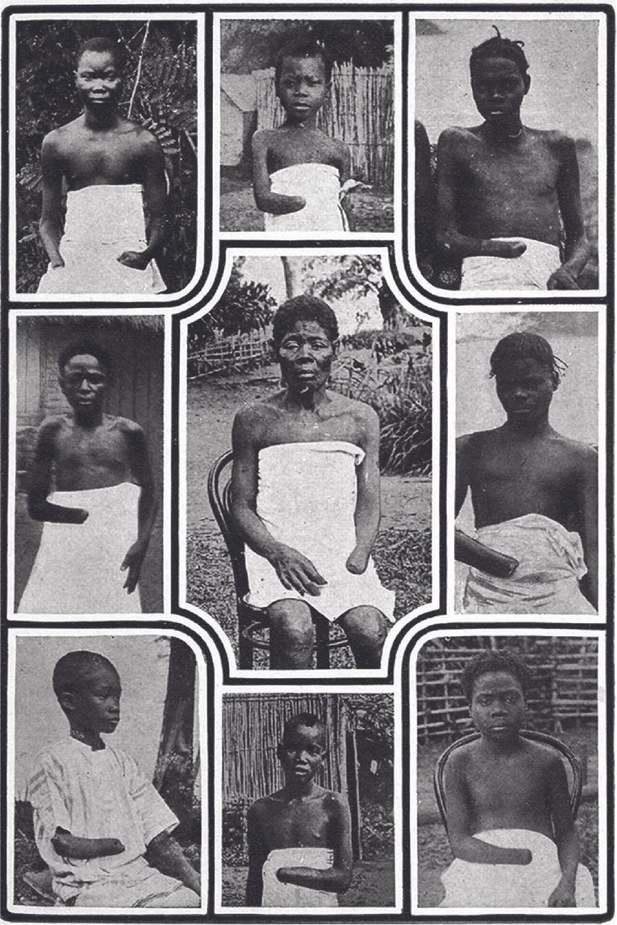 A photograph shows nine African American children and adults, in three rows of three. Eight of them wear only a cloth, either across their waist or higher on their chest, while one in the left bottom corner wears a while striped shirt. All of them are shown with one hand cut off. The backgrounds of the pictures show fields, straw huts, and wooden fences.